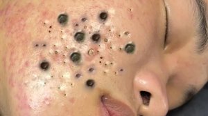 Расслабляющий уход за кожей: очищение 🧖
