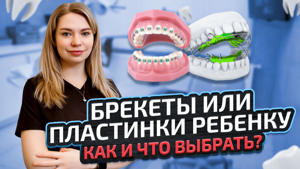 Брекеты у детей: как мода из TikTok меняет стоматологию и чем опасны наборы с Ozon