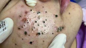 Успокаивающий уход за лицом для снятия стресса в спа-салоне