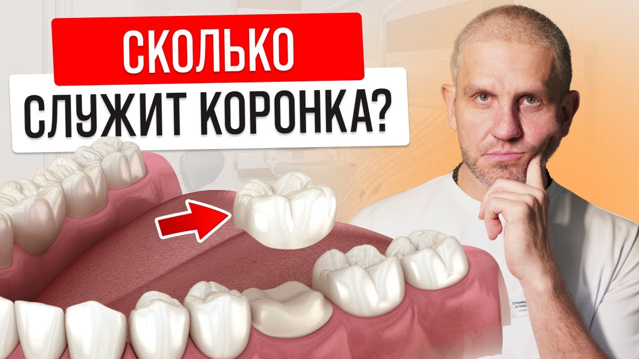 СКОЛЬКО прослужит и когда ПОРА менять ЗУБНЫЕ КОРОНКИ? смотреть онлайн
