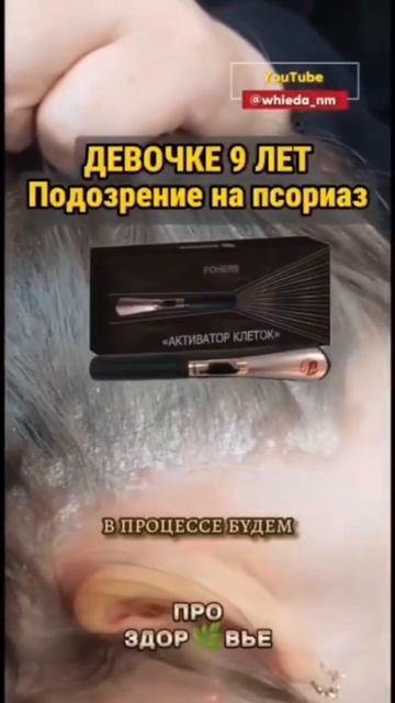 Активатор клеток от псориаза