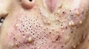 Расслабляющий уход за лицом для снятия стресса в спа-салоне