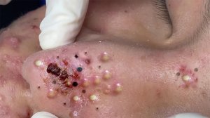 Достигните внутреннего покоя с помощью этих методов очищения лица