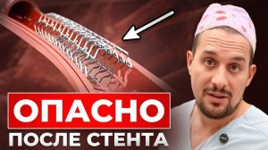 После установки Стента нельзя делать ЭТО…
