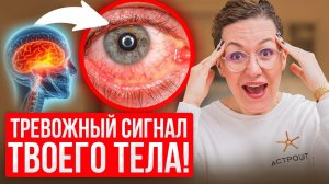 САМАЯ СИЛЬНАЯ БОЛЬ в мире! Как ВЫЖИТЬ при кластерной головной боли?