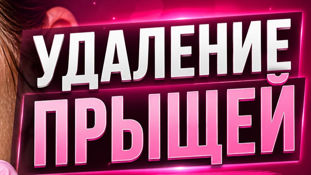 Удаление прыщей часть #3. Отличное качество!