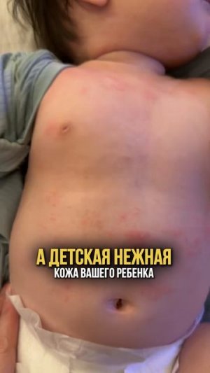 Вред влажных салфеток