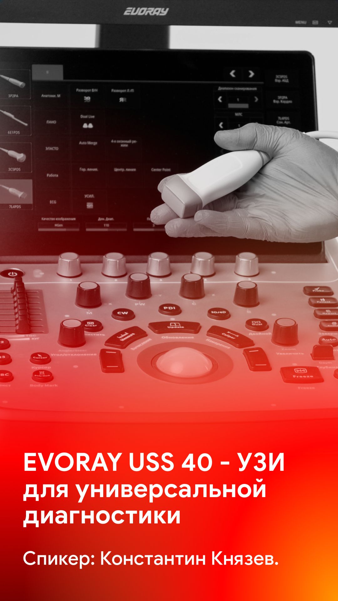EVORAY USS 40 - УЗИ аппарат для универсальной диагностики смотреть онлайн