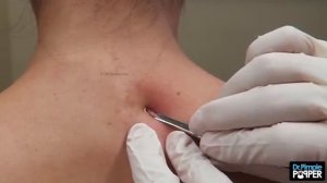 Не могу отвести взгляд! )ВЫДАВЛИВАЕТ ПРЫЩИ И УГРИ. СОЧНОЕ РЕЛАКС ВИДЕО