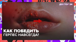 Почему появляется герпес на губах и как его лечить | Доктор 24