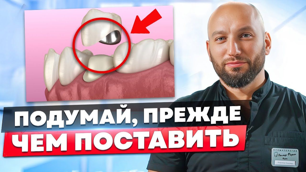 ПЛОМБА или КОРОНКА ? Что выбрать 🤔