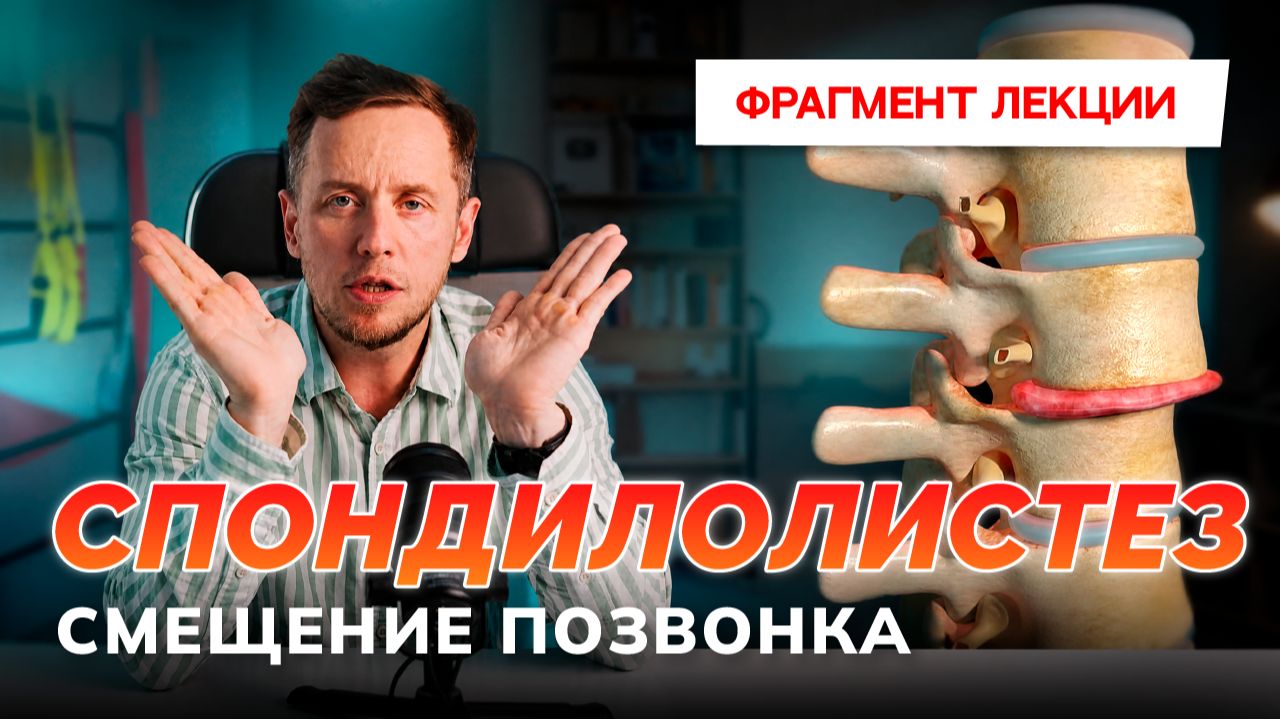 Спондилолистез: тактика ведения пациента. Патогенез и прогноз.