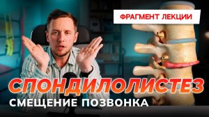 Спондилолистез: тактика ведения пациента. Патогенез и прогноз.