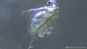 Drop of water under microscope. Капля воды из озера под микроскопом.