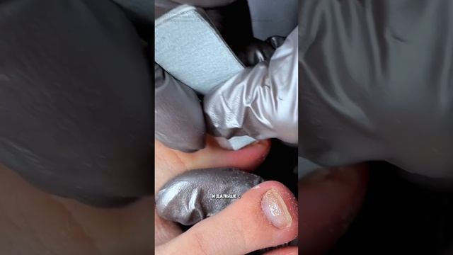 подстригайте ногти правильно, а то будет как на видео 🫶🏼 смотреть онлайн