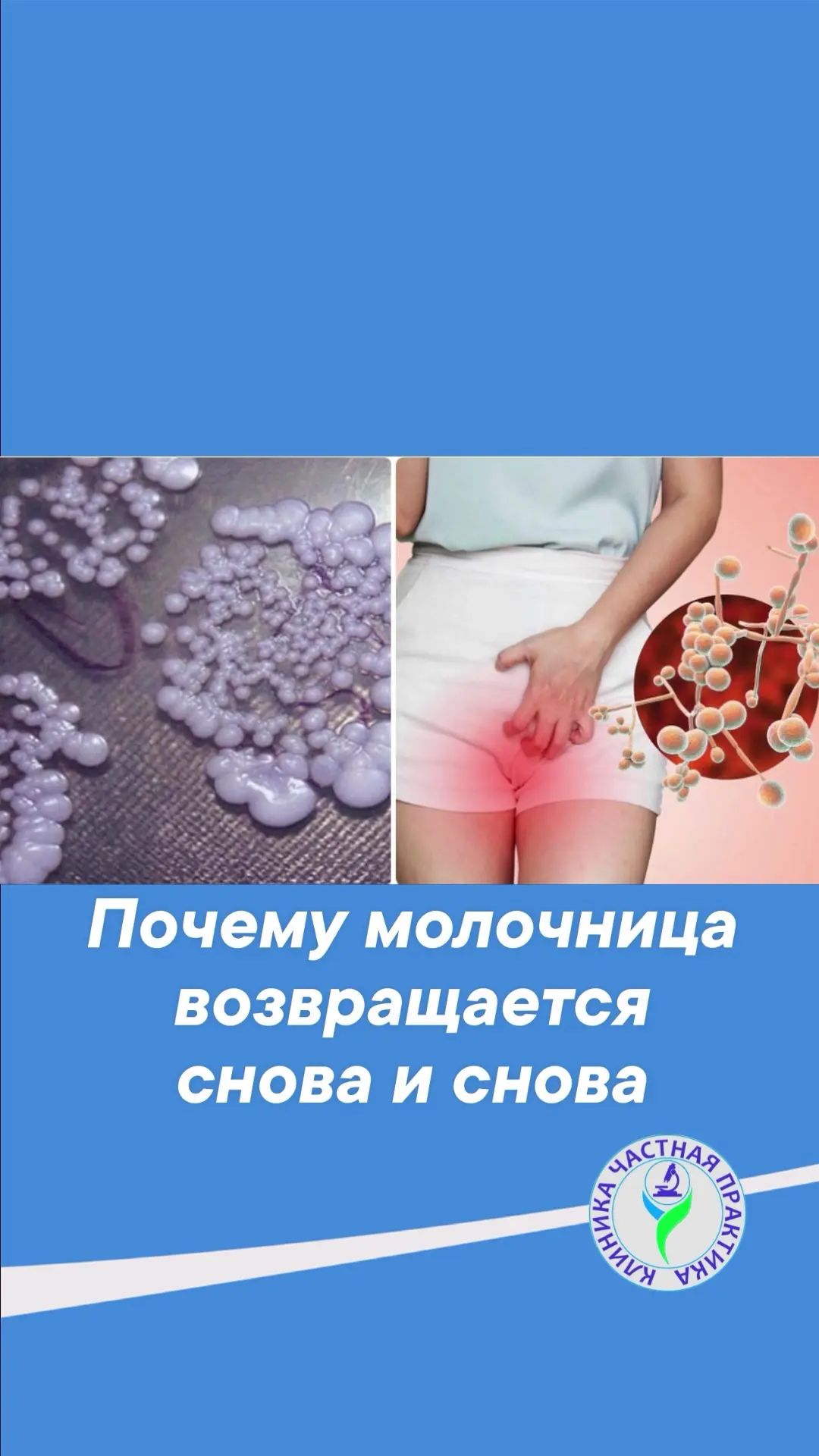 Боли Секса При Молочнице Боли Секса При Молочнице