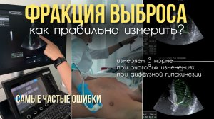ФРАКЦИЯ ВЫБРОСА – как правильно измерить? Разные примеры. Частые ОШИБКИ!