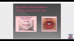 Развитие тактильной сенсорной системы