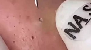 Советы по очищению и уходу за лицом