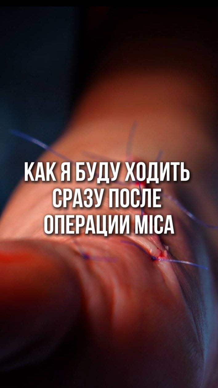 🏃♂️ Как я буду ходить после операции?