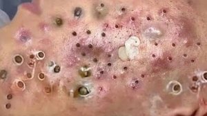 Успокаивающий массаж лица для снятия стресса в спа