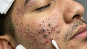 🧖 Нежное очищение лица и уход за кожей для глубокого расслабления