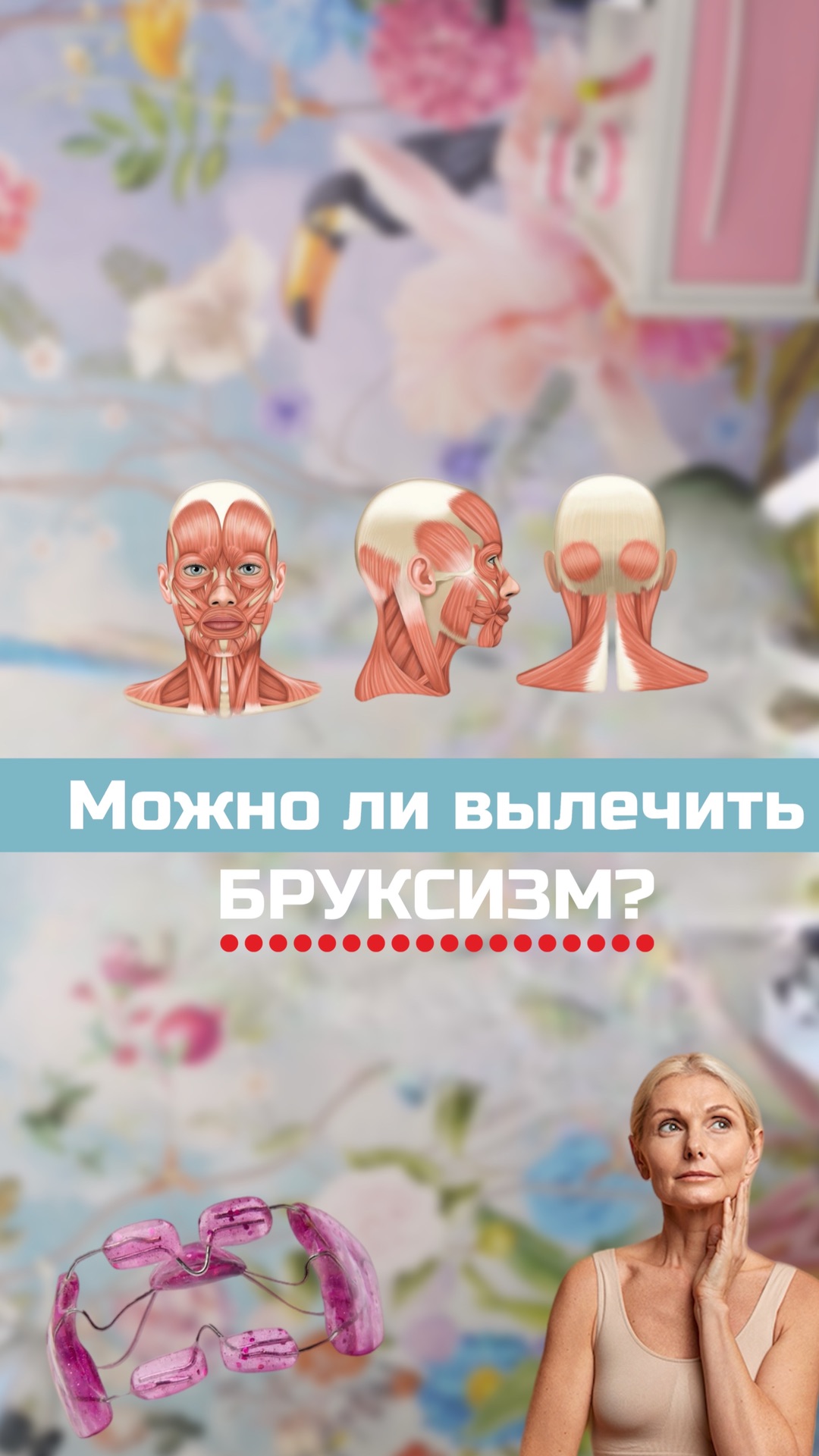 МИФАР при бруксизме — результаты исследования
