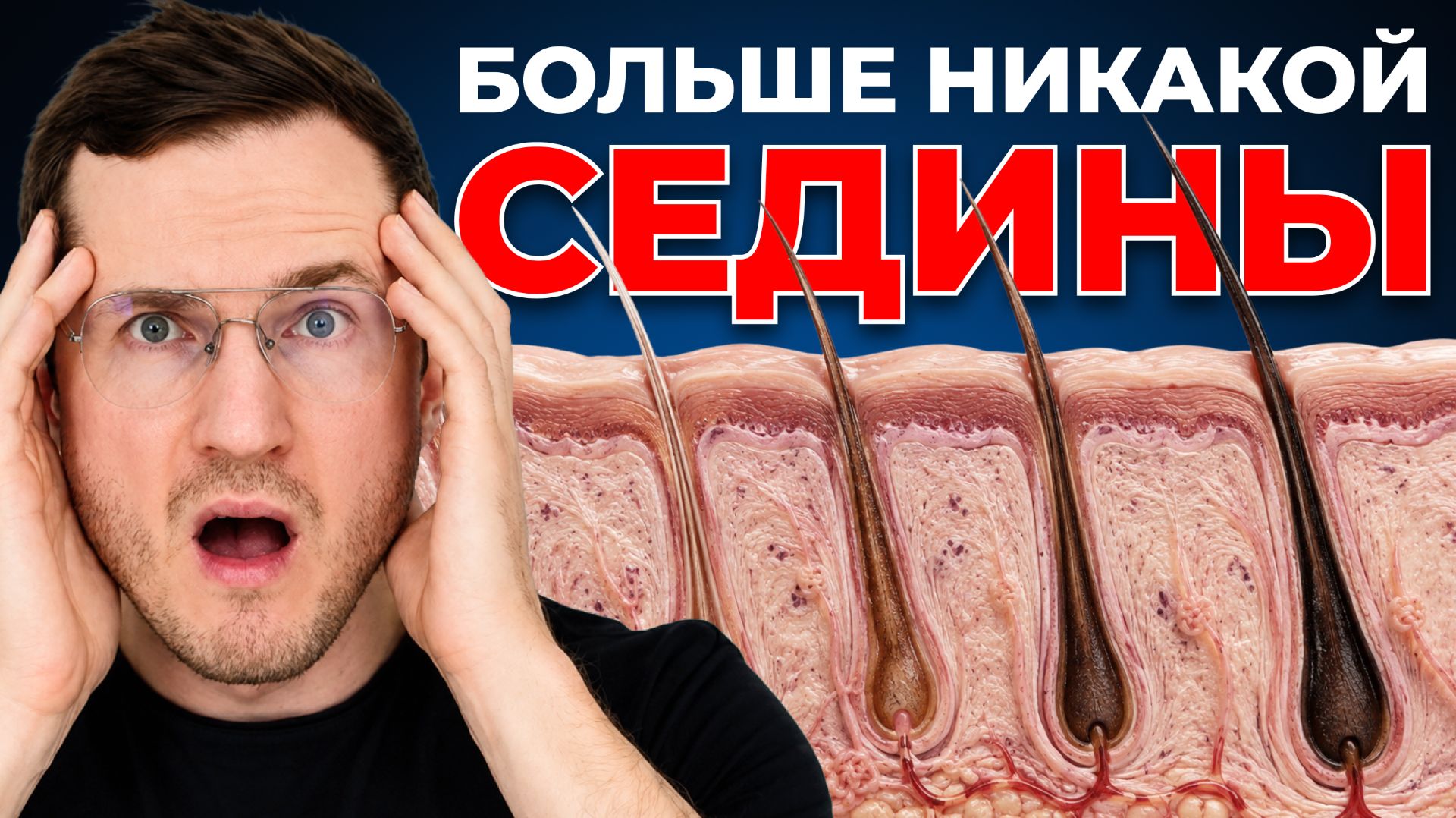 Это Остановит Поседение Волос (работает очень быстро) смотреть онлайн