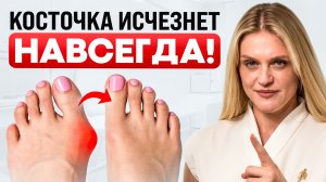 4 УПРАЖНЕНИЯ уберут КОСТОЧКУ на большом ПАЛЬЦЕ НОГИ! (исправь без операции)