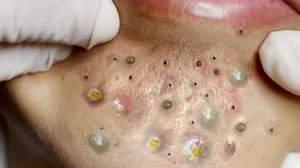 Советы по очищению и уходу за лицом 🧼✨