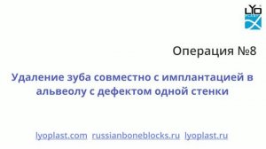 Операция №8 Удаление зуба совместно с имплантацией в альвеолу с дефектом одной стенки