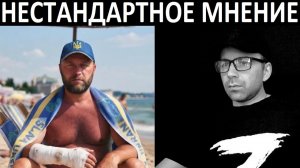 Украинец после ранения. Чат рулетка