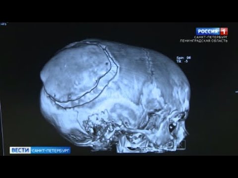 Помочь Алисе. смотреть онлайн