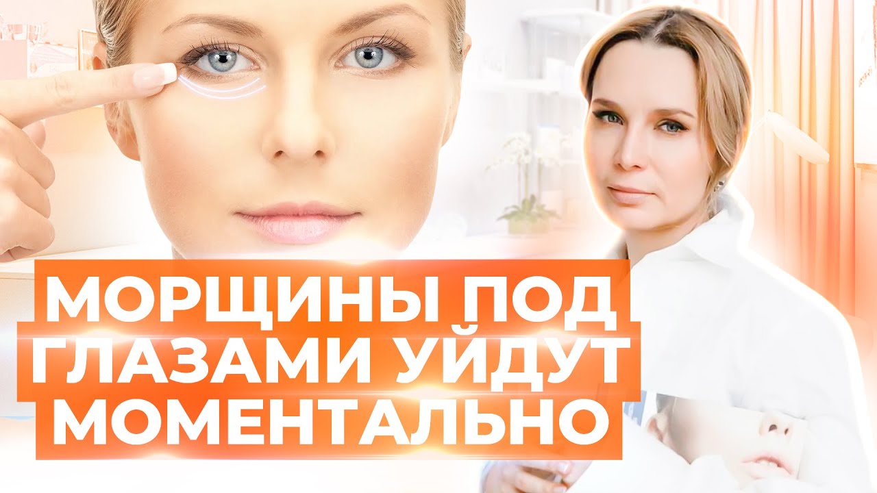 Как избавиться от морщин под глазами / Эффективные способы косметологии смотреть онлайн