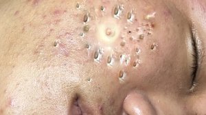 Расслабляющий уход за кожей: очищение для