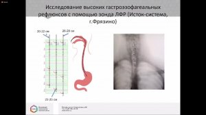 Валитова Э.Р. Особенности диагностики ларингофарингеальных рефлюксов