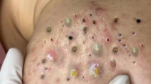 Поделитесь советами по очищению и уходу за лицом