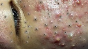 Успокаивающий уход за лицом для снятия стресса в спа-салоне