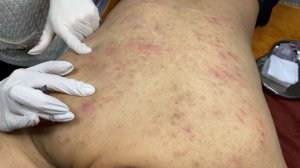310 • Acne collection • АСМР • Relax Spa