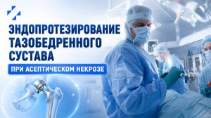 Эндопротезирование тазобедренного сустава у молодых и активных пациентов при асептическом некрозе