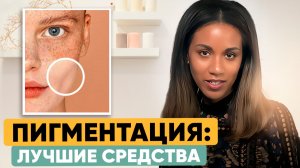 ПИГМЕНТАЦИЯ // Как избавиться от пигментации // Лучшие средства от пигментации