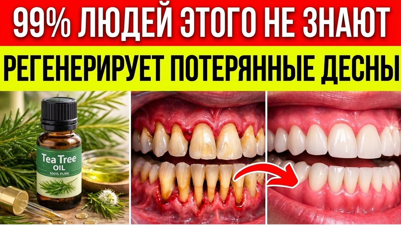 Секрет восстановления дёсен 7 средств с реальной научной основой (без операции) смотреть онлайн