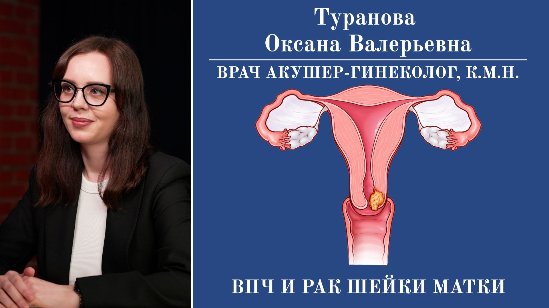ВПЧ и Рак шейки матки: Чем опасен вирус папилломы и какие последствия он несет смотреть онлайн
