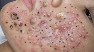 🧖 Мягкое очищение лица и уход за кожей для глубокого расслабления
