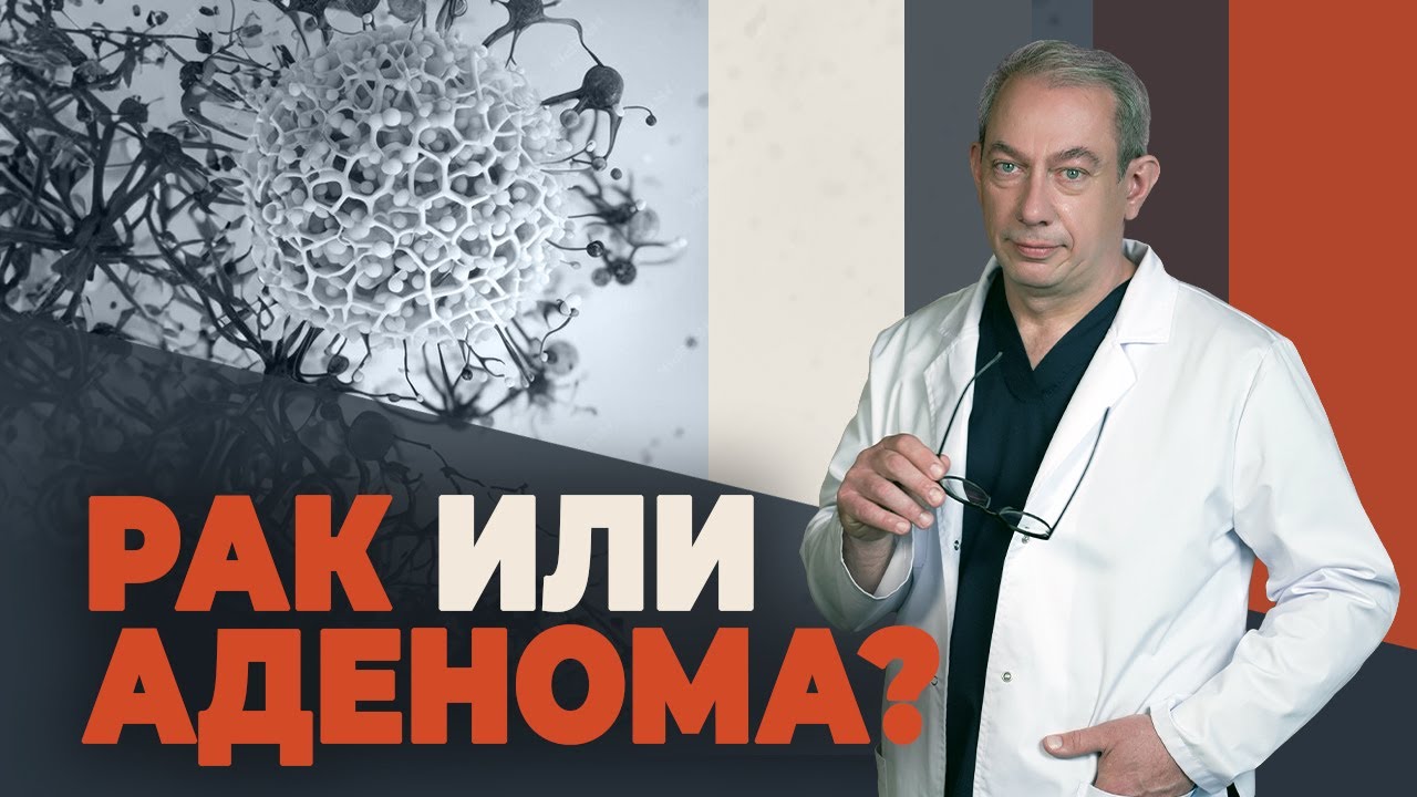 4 признака, как отличить рак от аденомы простаты смотреть онлайн