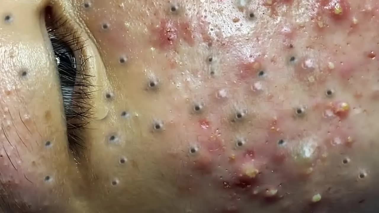 Успокаивающий уход за лицом для снятия стресса в спа-салоне