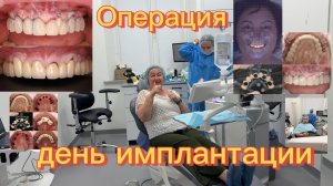 ВСЯ ПРАВДА 💯 Больно ли ставить зубные импланты⁉️ Все подробности: от А до Я❗️Мороженое пломбир 🍦