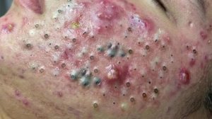🧖 Нежное очищение лица и уход за кожей для глубокого расслабления
