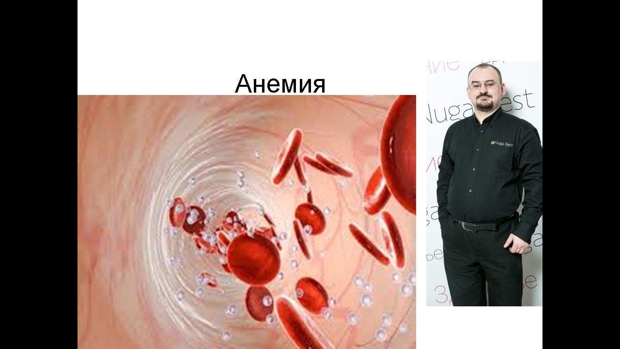 Анемия – малокровие – что это такое и как это лечить? смотреть онлайн