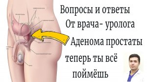 Доброкачественная гиперплазия предстательной железы вопросы и ответы от врача уролога